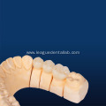 Premium Multilayered Zirconia for Restorative Dentistry